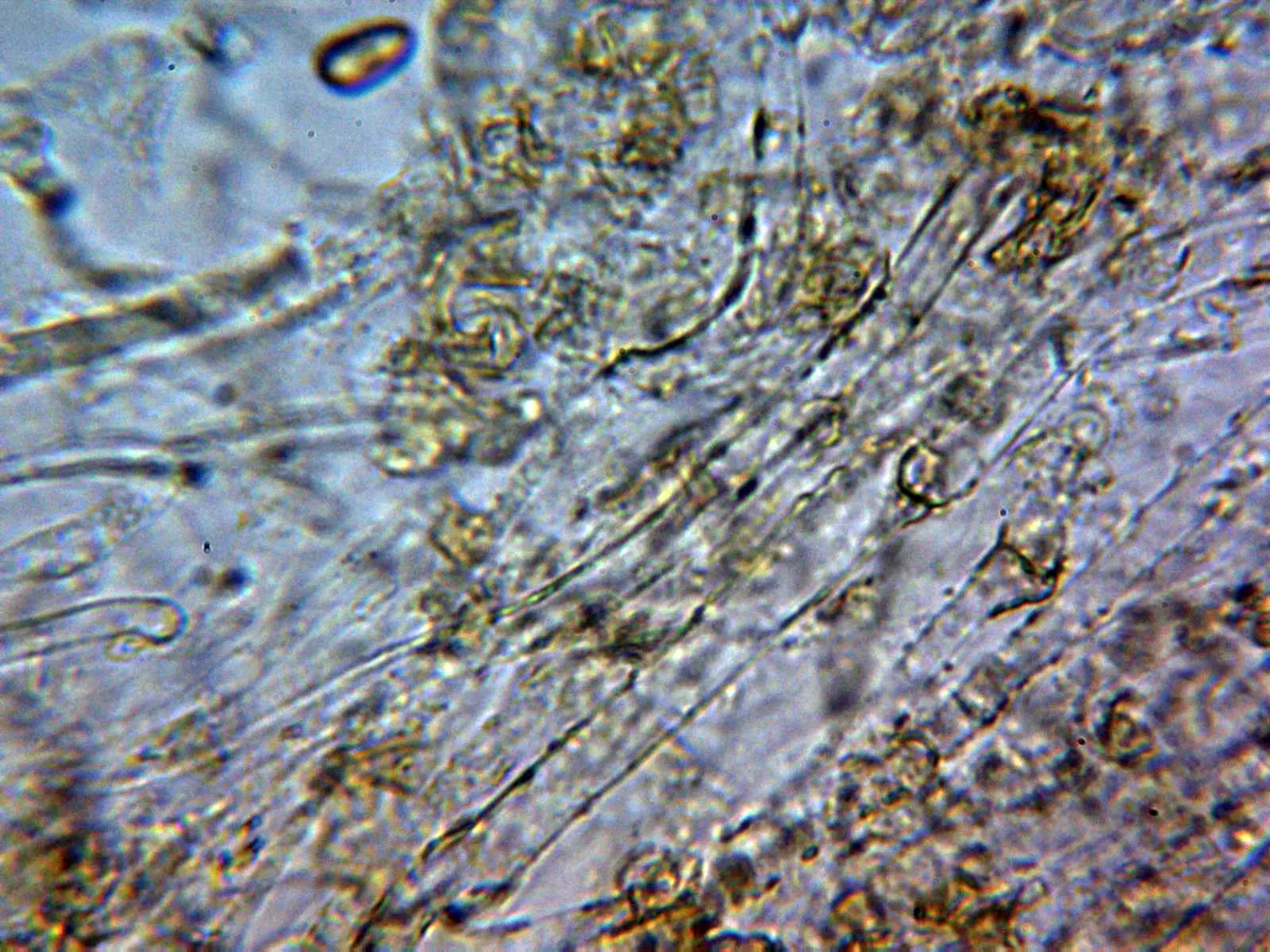 Microscopía de Pholiota conissans - 10 - Subpellis 2